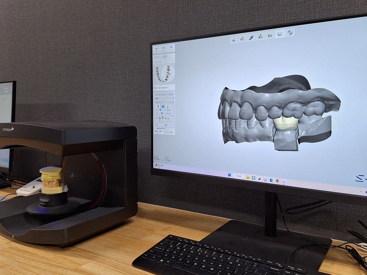 歯科医療および歯科技工に変革をもたらすデジタル技術 | 大阪大学